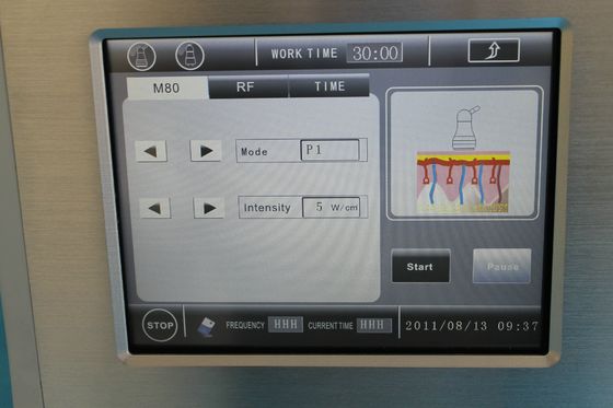 40Khz GS8.0 Ultrasonic Liposuction Cavitation RF Slimming Machine / Equipment